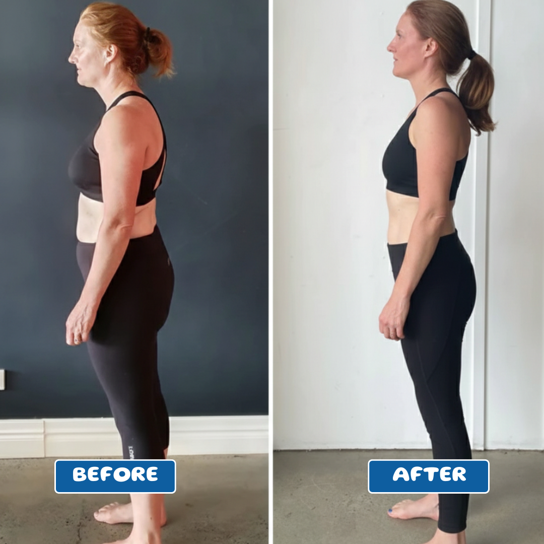 Adjustable Posture Corrector